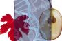 2022 065 Pflanzenschutz Biohacking gegen Pilzbefall